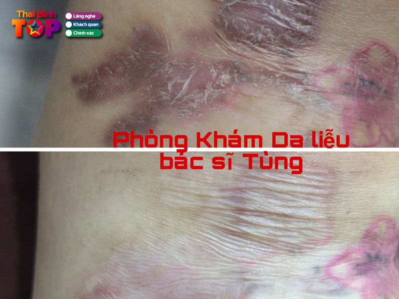 Phong-kham-da-lieu-bac-si-tung-thaibinhtoplist