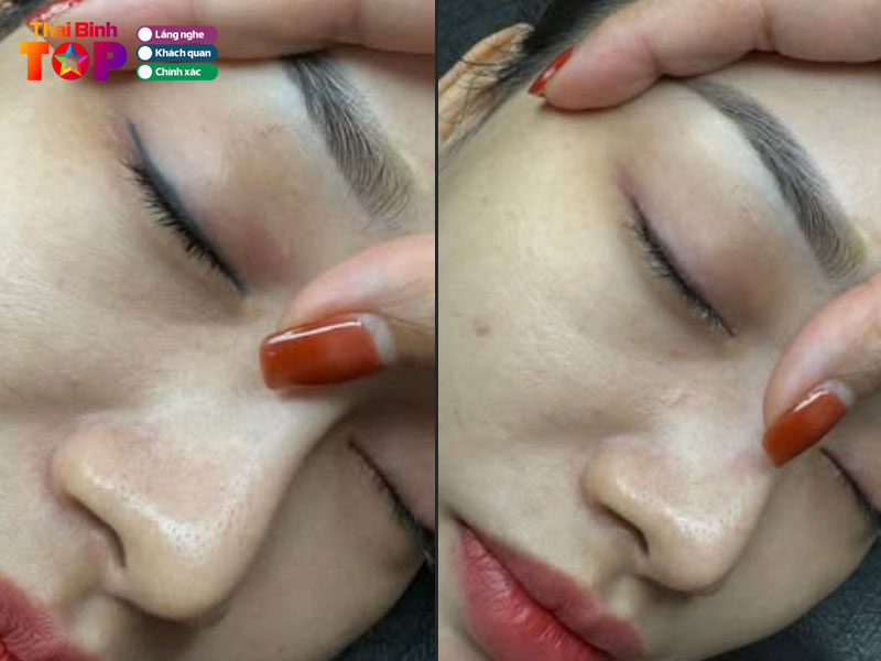 Loc-spa-thaibinhtoplist