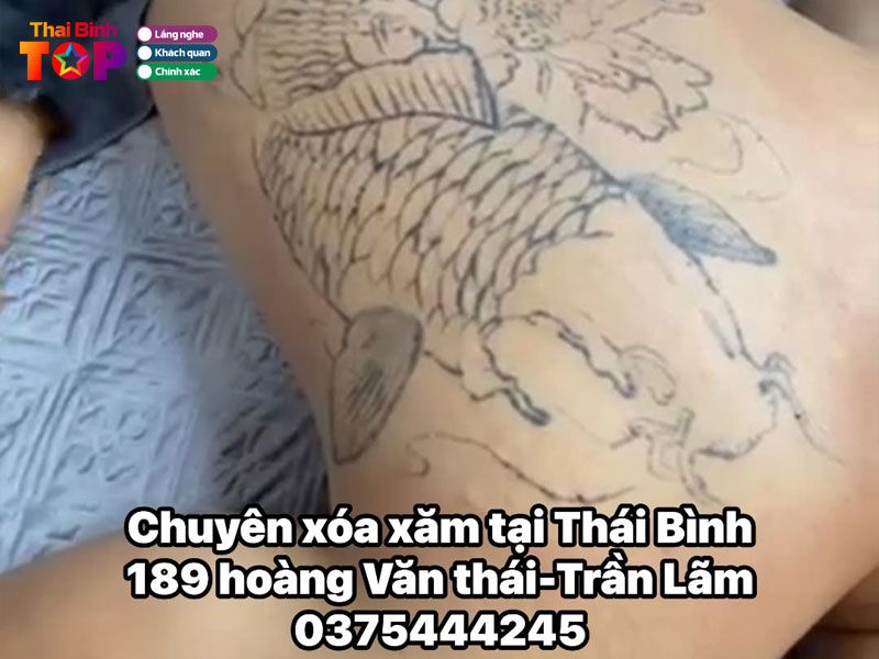 Tham-my-thien-huong-thaibinhtoplist